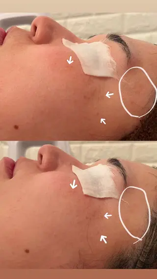 毛穴ケア/毛穴診断/ 毛穴洗浄〔心斎橋〕のエステ・リラクイメージ