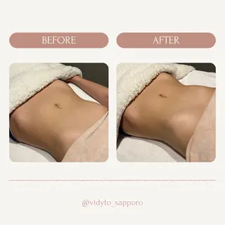 【vidyto】ヴィディトゥ所属・肌管理サロン vidyto　MOEのエステ・リラクイメージ