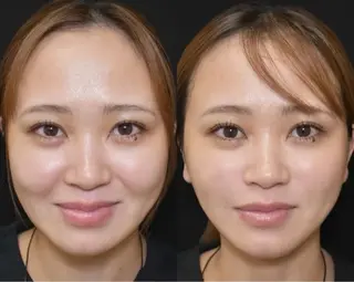 マツエク・マツパ aliaハイフ&水光ジェットサロン所属・aliaハーブ水光店 エステティシャン募集のエステ・リラクイメージ