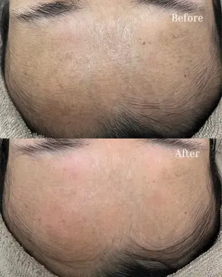 BELLIS HUIT所属・ハーブピーリング那覇 BELLISHUITのエステ・リラクイメージ