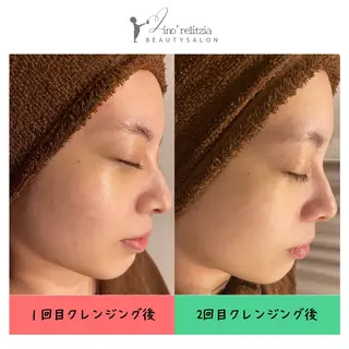 リノレリチア 新町店のエステ・リラクイメージ