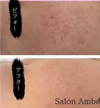 サロン　Ambelle所属・北川 亜友美のエステ・リラクイメージ