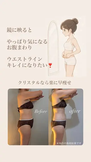 Crystallo Sana N所属・痩身・リンパ 佐久間 自由が丘・奥沢のエステ・リラクイメージ