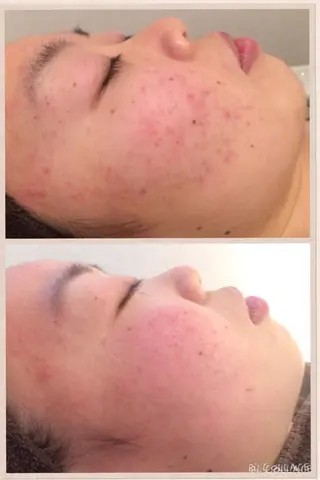 ミディアム カラー パーマ ヘアアレンジ メンズ キッズ ネイル マツエク・マツパ ニキビ・肌質改善専門 ♡人生が変わるサロンのエステ・リラクイメージ