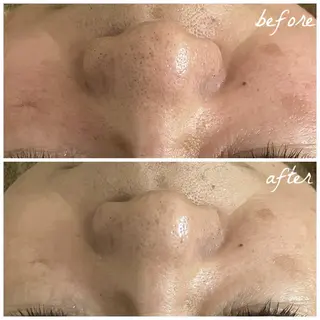 メンズ メナード岐阜茜部 杉浦のエステ・リラクイメージ