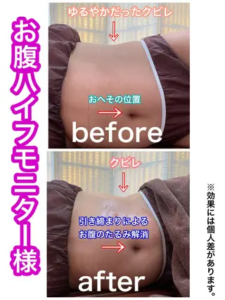 痩身/脱毛/ネイル HARUKAのエステ・リラクイメージ