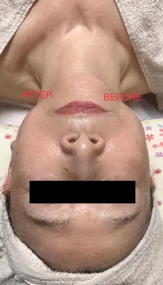 ショート LUCIALL  ルシアル所属・児玉 愛由美のエステ・リラクイメージ