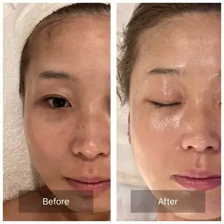 mine.mマインエム所属・mine.mi マインエムのエステ・リラクイメージ