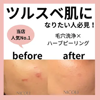 エステサロン NICOLIのエステ・リラクイメージ