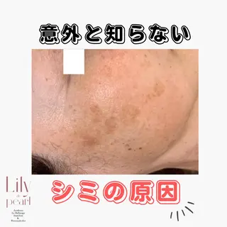 最新シミケアLily de pearlのエステ・リラクイメージ