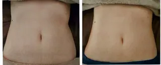 Mon amou【モナムー】のエステ・リラクイメージ