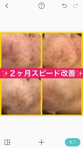 ミディアム マツエク・マツパ ニキビ・肌質改善専門 ♡人生が変わるサロンのエステ・リラクイメージ