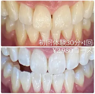 メンズ ホワイトニングルーム　川崎店所属・ホワイトニング ルーム　川崎店のその他イメージ