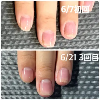 ネイル 奥園 良恵のネイルデザイン