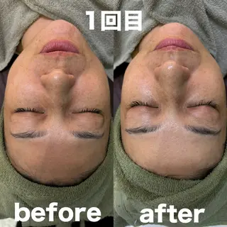 肌質改善 陶器肌🌿のエステ・リラクイメージ