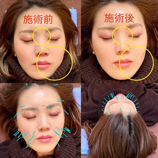 鍼灸整体院　蕾所属・美容鍼 蕾【谷町六丁目】のエステ・リラクイメージ