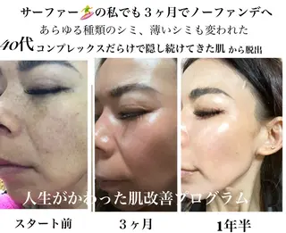 private salon  Dea_maris シュガーリング＆パーソナルボディケア所属・シミ改善・韓国肌管理 ボディメイク痩身のその他イメージ