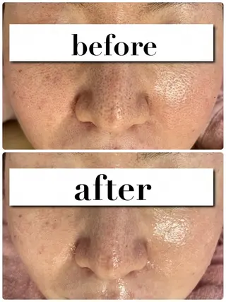 CEサロンbelle mona所属・CEサロン belle monaのエステ・リラクイメージ