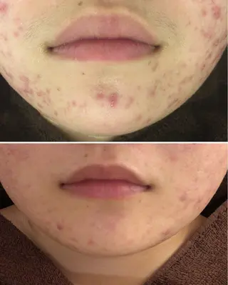 ミディアム カラー パーマ ヘアアレンジ メンズ キッズ ネイル マツエク・マツパ ニキビ・肌質改善専門 ♡人生が変わるサロンのエステ・リラクイメージ