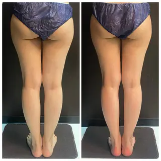 ハイパーナイフEX 小顔×痩身ケアのエステ・リラクイメージ