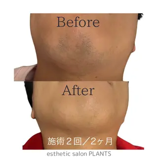 メンズ esthetic salon PLANTS所属・エステティックサロン PLANTSのエステ・リラクイメージ