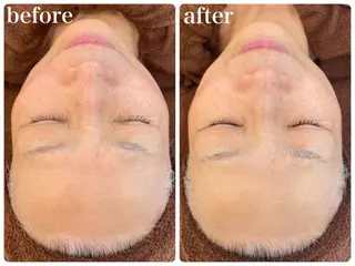 パーソナル肌質改善 🦋APRI🅿️有のエステ・リラクイメージ