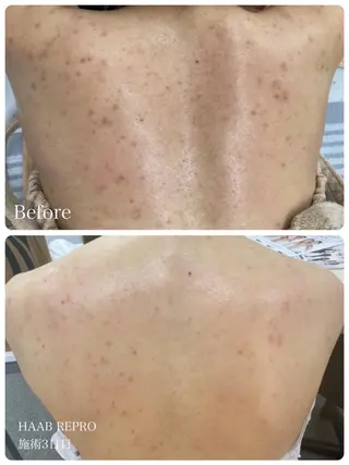 1ヶ月後も半分残る 高持続LEDエクステのマツエク・マツパデザイン