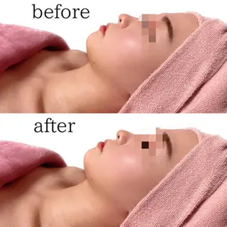 エステ脱毛 MAIのエステ・リラクイメージ