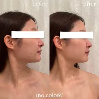 エステサロンino.colore'所属・小顔サロン ino.coloreのエステ・リラクイメージ