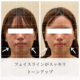 美容鍼/ヘッドスパ/ 💎さかもとのエステ・リラクイメージ