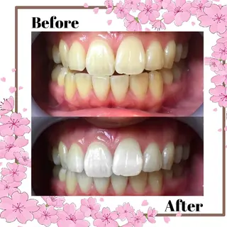 LBS吉祥寺 公式のエステ・リラクイメージ