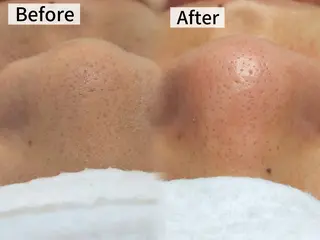 LUMINAESTH所属・LUMINA ESTHのエステ・リラクイメージ