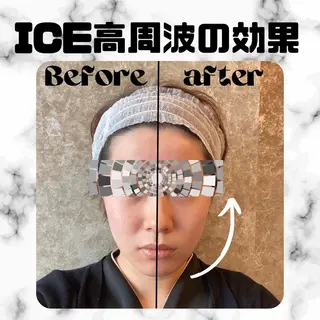 メンズ 男女同額完全個室脱毛 LEPIA内田のエステ・リラクイメージ