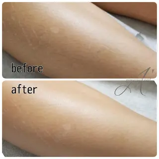 ミディアム カラー パーマ ヘアアレンジ メンズ ネイル マツエク・マツパ キッズ A*《エースター》 シュガーリング🍋のエステ・リラクイメージ