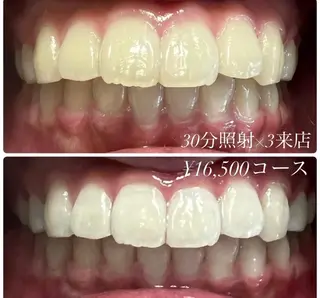 メンズ キッズ ホワイトニングルーム　川崎店所属・ホワイトニング ルーム　川崎店のその他イメージ