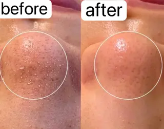 Belle原宿所属・佐藤 加奈のエステ・リラクイメージ