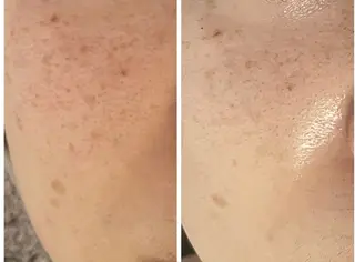 エイジングケア専門店 richbelle所属・エイジングケア専門 richbelleのエステ・リラクイメージ