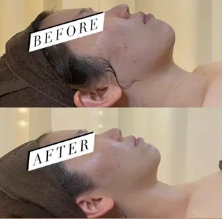 BELCIA福岡店　récolte de BELCIA（レコルトデベルシア）所属・BELCIA福岡店 レコルトデベルシアのエステ・リラクイメージ