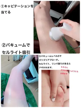 痩身/脱毛/ネイル HARUKAのエステ・リラクイメージ