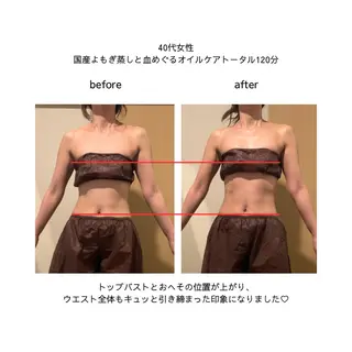 一坪(ひとツボ)サロンあぷり所属・よもぎ蒸し・腸もみ 石川理沙のエステ・リラクイメージ