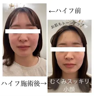 kelly moekaの眉毛・アイブロウイメージ