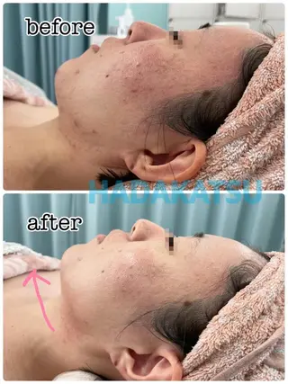 総合エステサロン 肌活のエステ・リラクイメージ