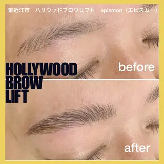 アイブロウ epismoo 脱毛/HBL/毛穴の眉毛・アイブロウイメージ