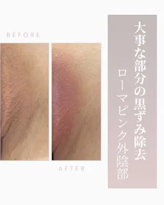 ロゼ ブランシュのエステ・リラクイメージ