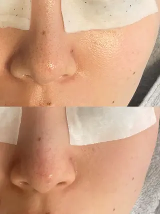 Lien ~beauty salon~所属・福島⌇毛穴専門サロン ⌇﻿モニター募集のエステ・リラクイメージ