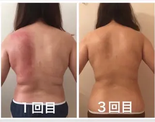 トータルビューティ サロンstageのエステ・リラクイメージ