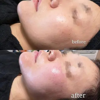 🅖🅤🅩🅔🅛 salonのエステ・リラクイメージ