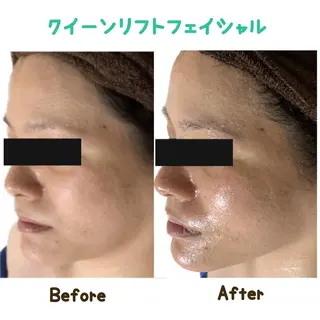 ヴィーナス ビューティーのエステ・リラクイメージ