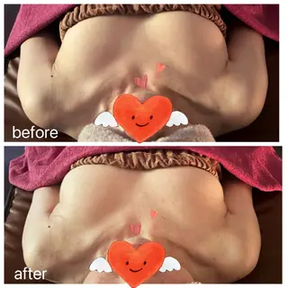 バストアップ専門 おっぱい先生いそのその他イメージ