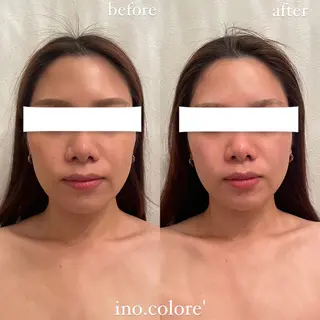 エステサロンino.colore'所属・小顔サロン ino.coloreのエステ・リラクイメージ